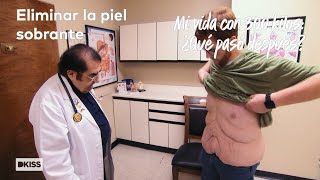 Operación para eliminar el exceso de piel | Mi vida con 300 kilos: ¿Qué pasó después?