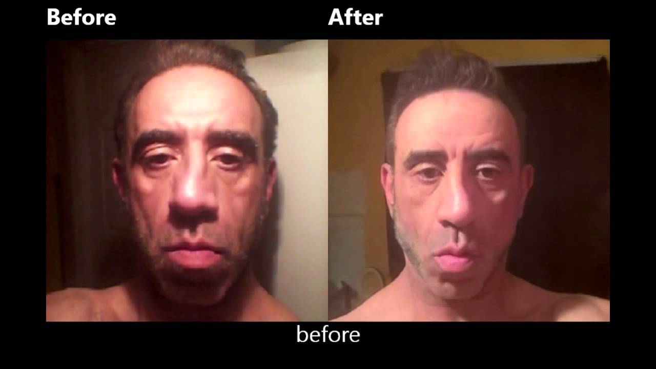 face slimming exercises before and after before and after