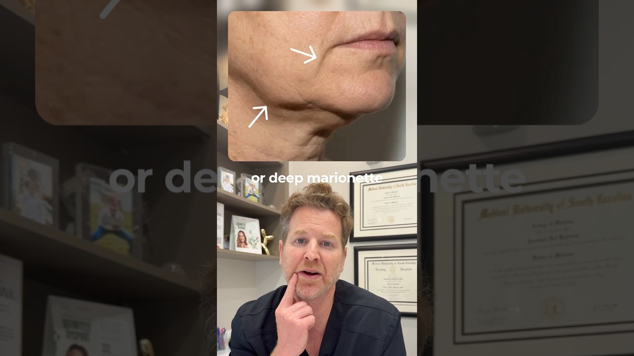 What is the right age for a facelift?