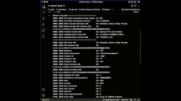 Extract DICOM Informations On Python #python #ai #deeplearning
