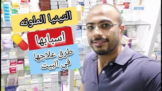 التينيا الملونه اسبابها وعلاجها وازاى تتخلص منها نهائيا مع |د. محمد مجدى