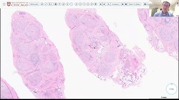 AANP Teaching Rounds - October 22, 2025 - Peripheral Nerve Biopsies