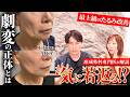 本気でたるみに悩む人だけ見て!形成外科専門医森永先生の症例写真が凄すぎるので全てお見せします。