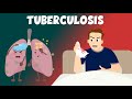 Tuberculosis: Causes, Symptoms, Diagnosis &amp; Treatment - Learning Junction