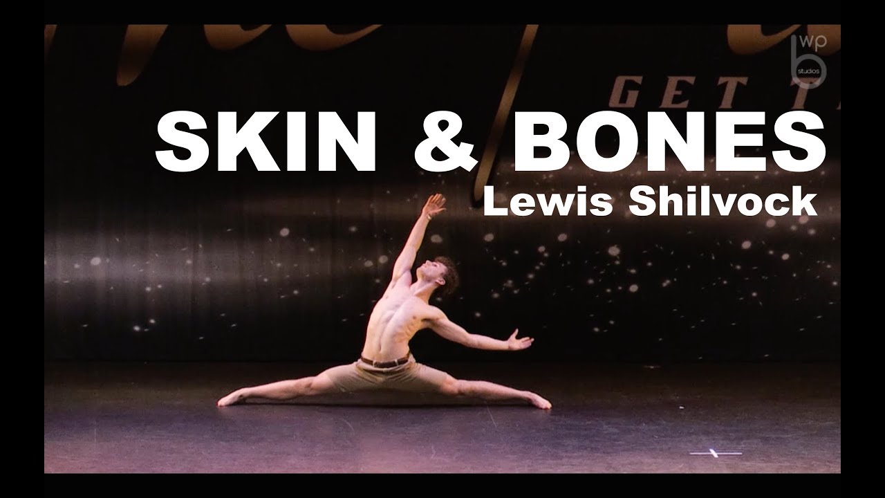 Skin and Bone. Skin and bones david