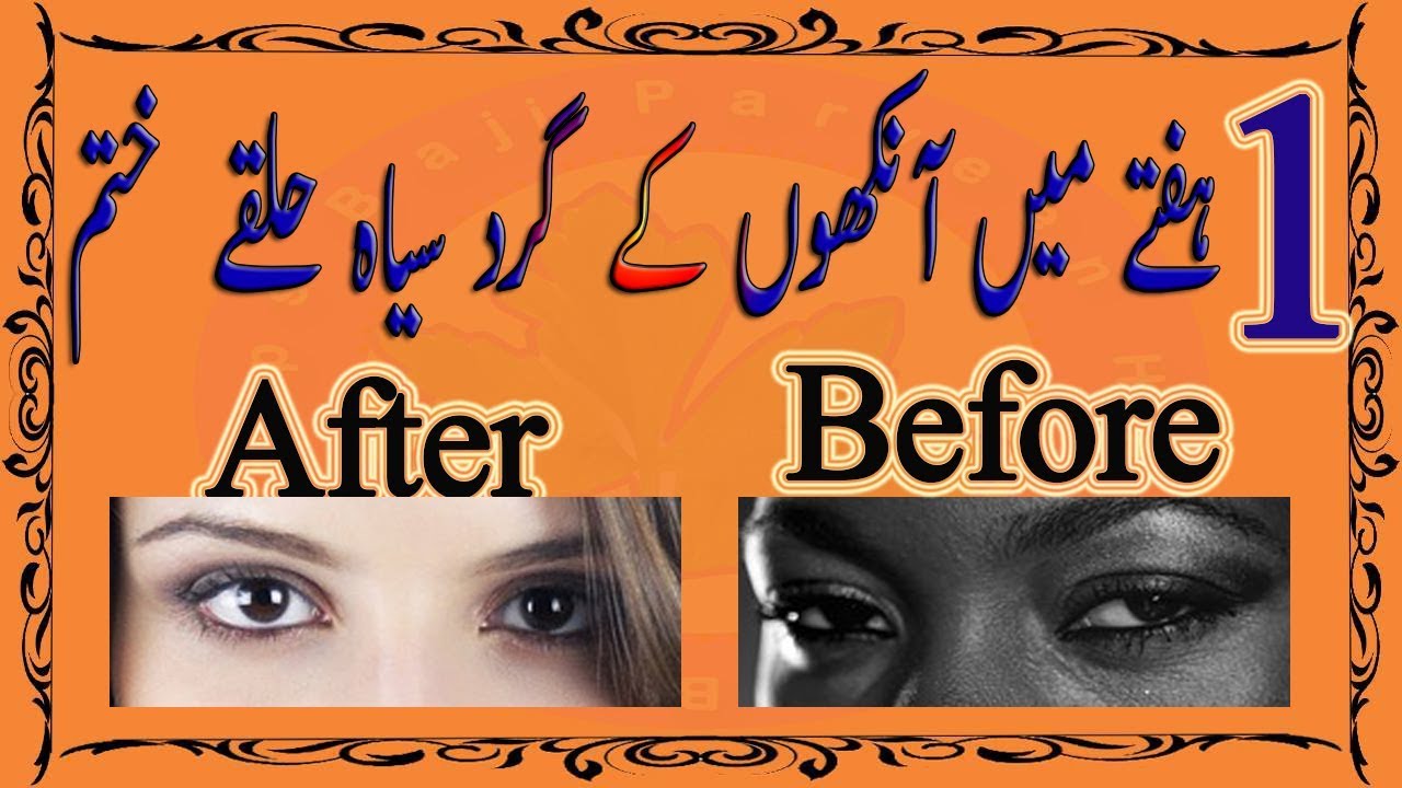 Eyes Black Circles Remove How to Remove Dark Circles Naturally in One