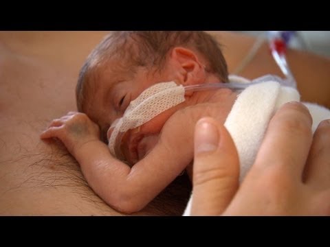 Video: Oog- En Oorproblemen Bij Premature Baby's: ROP En Meer