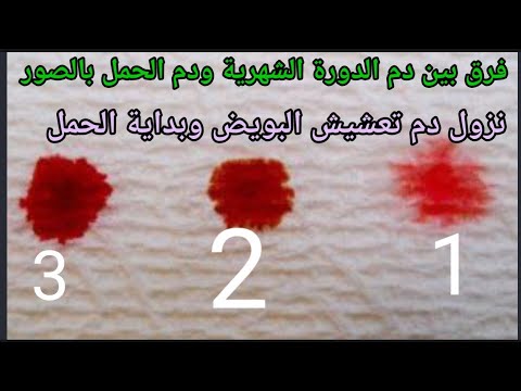 خاصك تعرفي الفرق بين دم الدورة ودم الحمل بالصور/ لا تقعي في هاد غلط ويتأخر حملك لسنوات 🖐️🤔