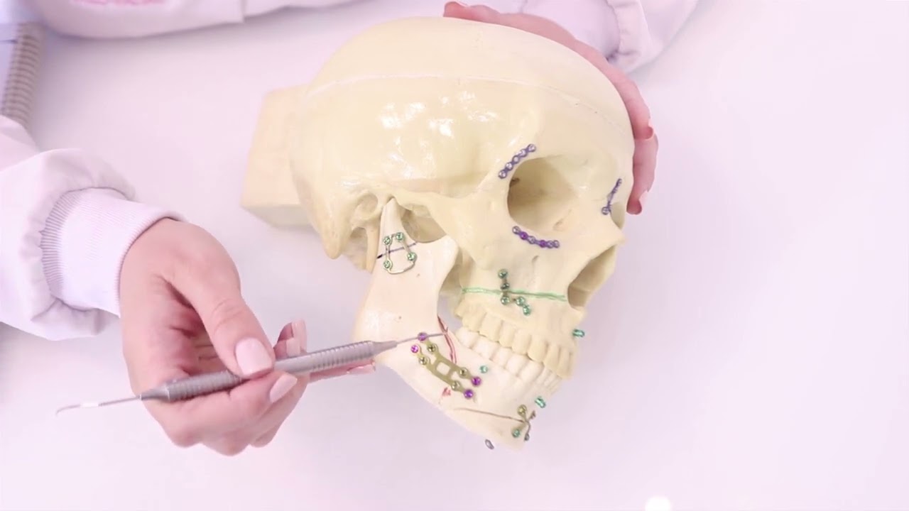 Osteotomia Sagital e Osteotomia em L invertido.