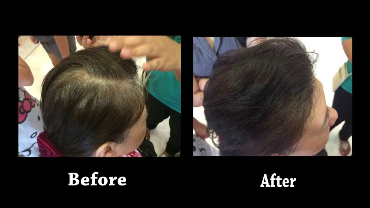 KeraPlus Hair Loss Concealer