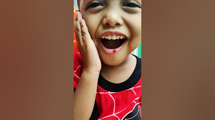 bibir deffan luk4 kluar dar*h😱 #shorts