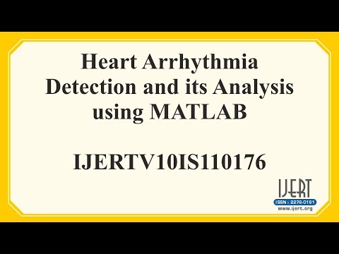 Heart Arrhythmia Detection and its Analysis using MATLAB