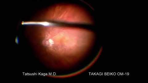 Microscopio quirúrgico TAKAGI OM-19 - Grupo Aldai