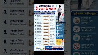 🦴हड्डियों के फ्रैक्चर के 10 प्रकार | Types of Bone🩻 Fracture Explained in Hindi