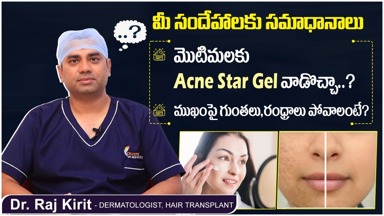 ముఖంపై గుంతలు పోవాలంటే How to Remove Open Pores Naturally Dr Raj
