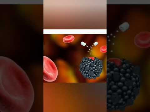 ما خطورة ارتفاع مخزون الحديد