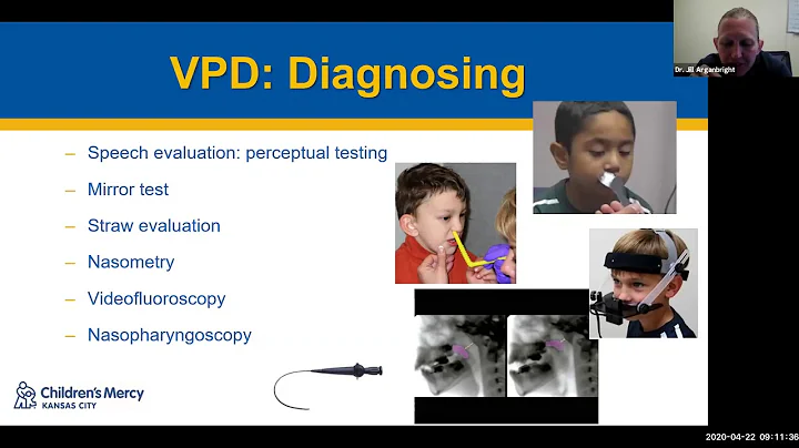 Velopharyngeal insufficiency: evaluation and surgical management - Dr. Jill Arganbright