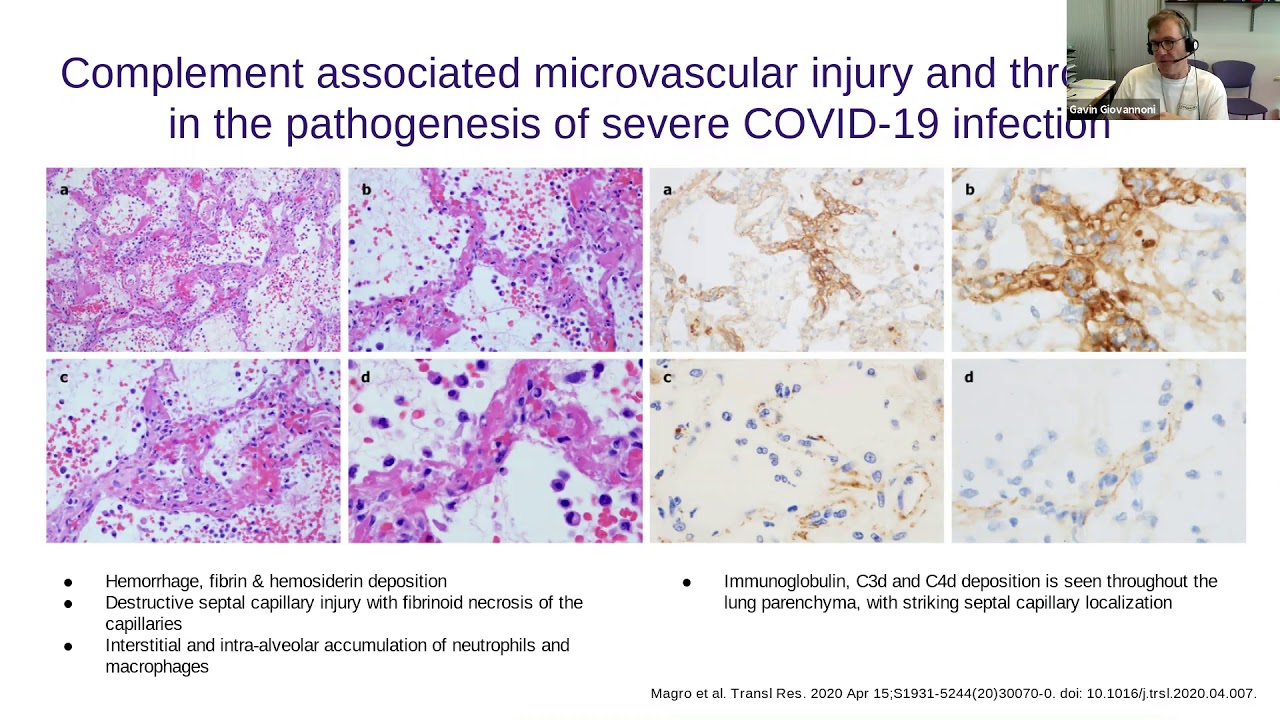 Anti CD20 Therapies COVID 19 And Vaccine Readiness YouTube