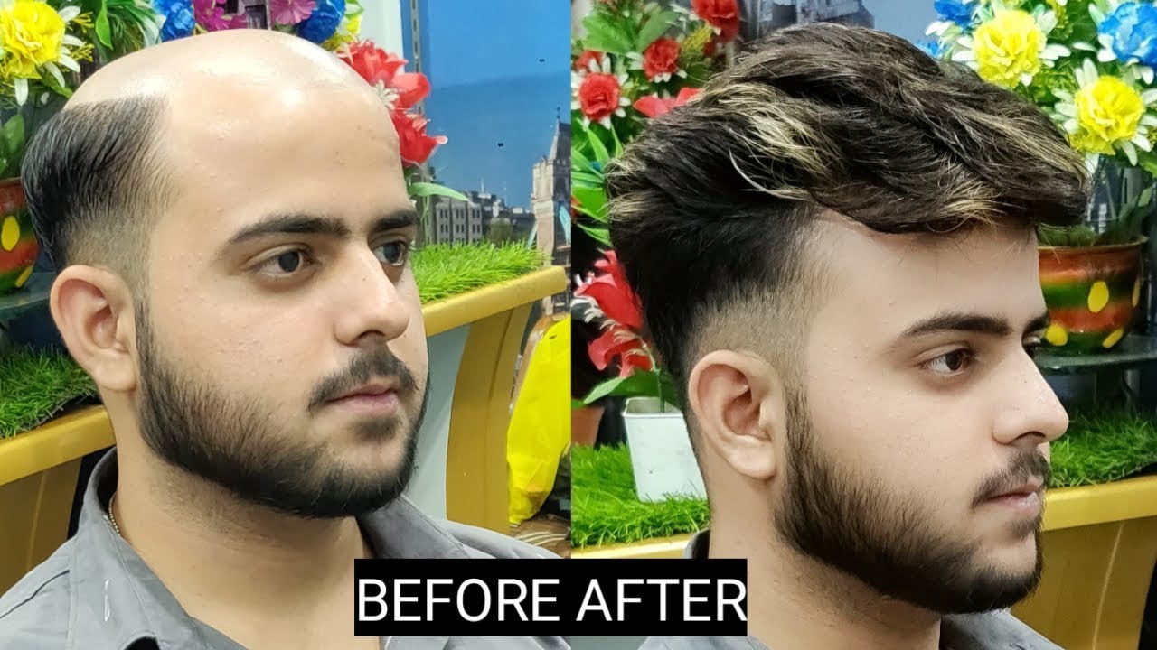 BEFORE  AFTER ultra thin base hair patch system for man  9582581323   YouTube