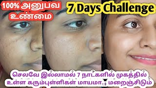 7 Days Dark spots Remove Challenge/How to get rid of black dots/How to remove pimple marks in tamil