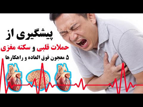 تصویری: چگونه می توان از کارهای روزمره جلوگیری کرد