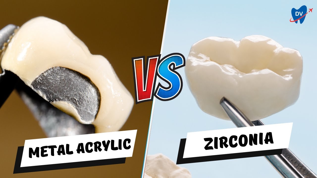 Metal Acrylic Vs Zirconia Which is Better for Implants in Costa Rica? YouTube