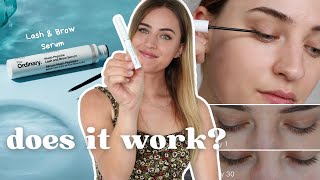 'The Ordinary LASH & BROW SERUM' 30 day REVIEW - before & after results. Worth it?? by Anna Sophia 2,399 views 4 months ago 10 minutes, 29 seconds