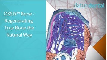 OSSIX™ Bone - Regenerating True Bone the Natural Way!