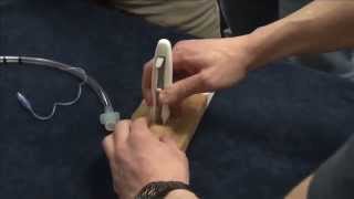 The Levitan Cric-Knife & Cric-Key demo'd by Emcrit