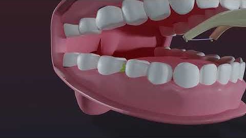 BETWEETH Floss Holder 2.0