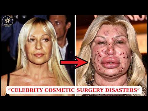 Celebrity Disaster! The Fallout You Won't Forget!