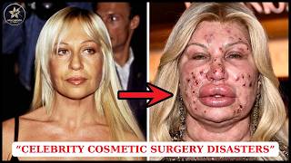 35 Celebrity Plastic Surgery Disasters – You’d Never Recognize Them Today! | Then and Now 2026