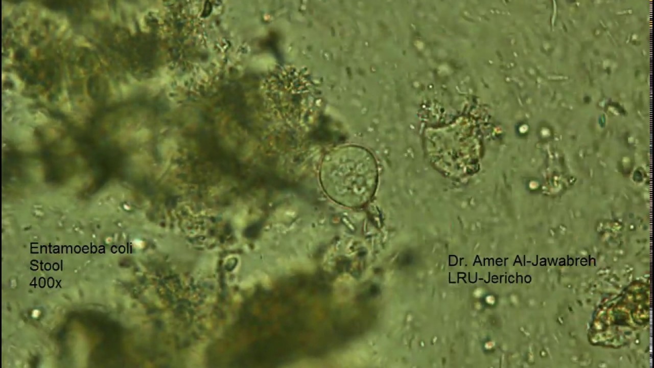 Entamoeba coli в кале