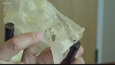 Doctors use 3-D printed hearts to test procedures before surgery