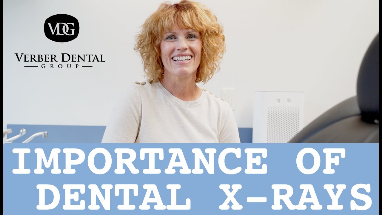 Why Are Dental XRays Important? YouTube