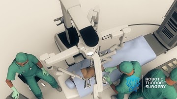 What Is a Robotic Lobectomy?