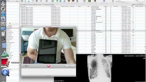 008 TransferDICOMfromMactoiPad