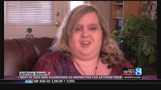 Teen uses photography to shine light on autism, mitochondrial disease