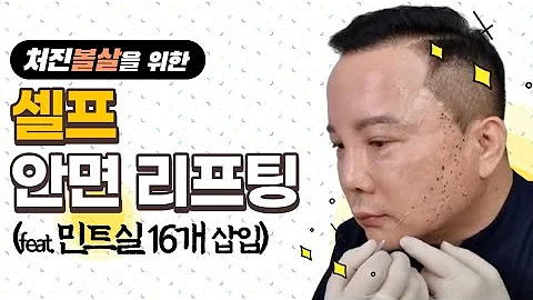 쳐진 턱살과 볼살을 위해 민트실 16줄을 셀프로 넣어 보았더니 10년 젊어졌습니다