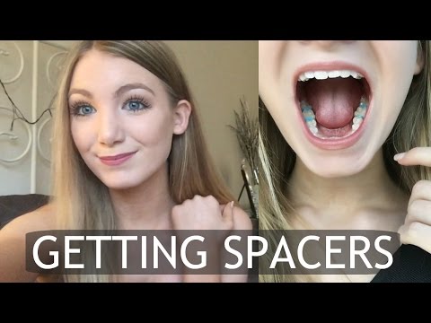 What Are Teeth Spacers For Braces And Are They Painful