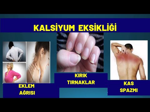 Video: Sağlık İçin Morina Karaciğeri Yağı Nasıl Kullanılır: 7 Adım (Resimlerle)