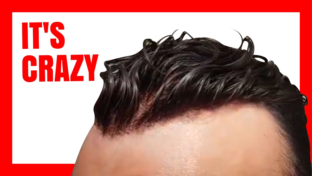 My HAIR REPLACEMENT SYSTEM ...I LOVE IT !!!! TOUPEES ONLINE