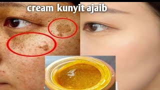 nyesel baru tau,coba cream kunyit selama 1Minggu dan tetangga kaget dengan hasilnya yang menakjubkan