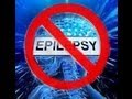 Epileptic seizure treatment frequency