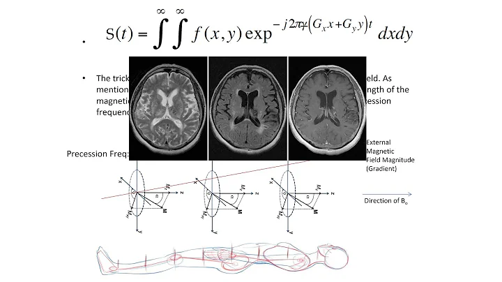 NeuroImaging & NeuroRadiology - Theory & Practice - CT + MRI - Neuroscience Lecture Series