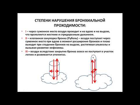 Бронхообструктивный синдром, синдром повышенной воздушности легочной ткани (эмфизема)