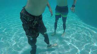 Dream Team Prosthetics presents Genium X3 Waterproof Knee