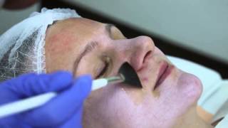 Dermatologia Bielsko Peelingi