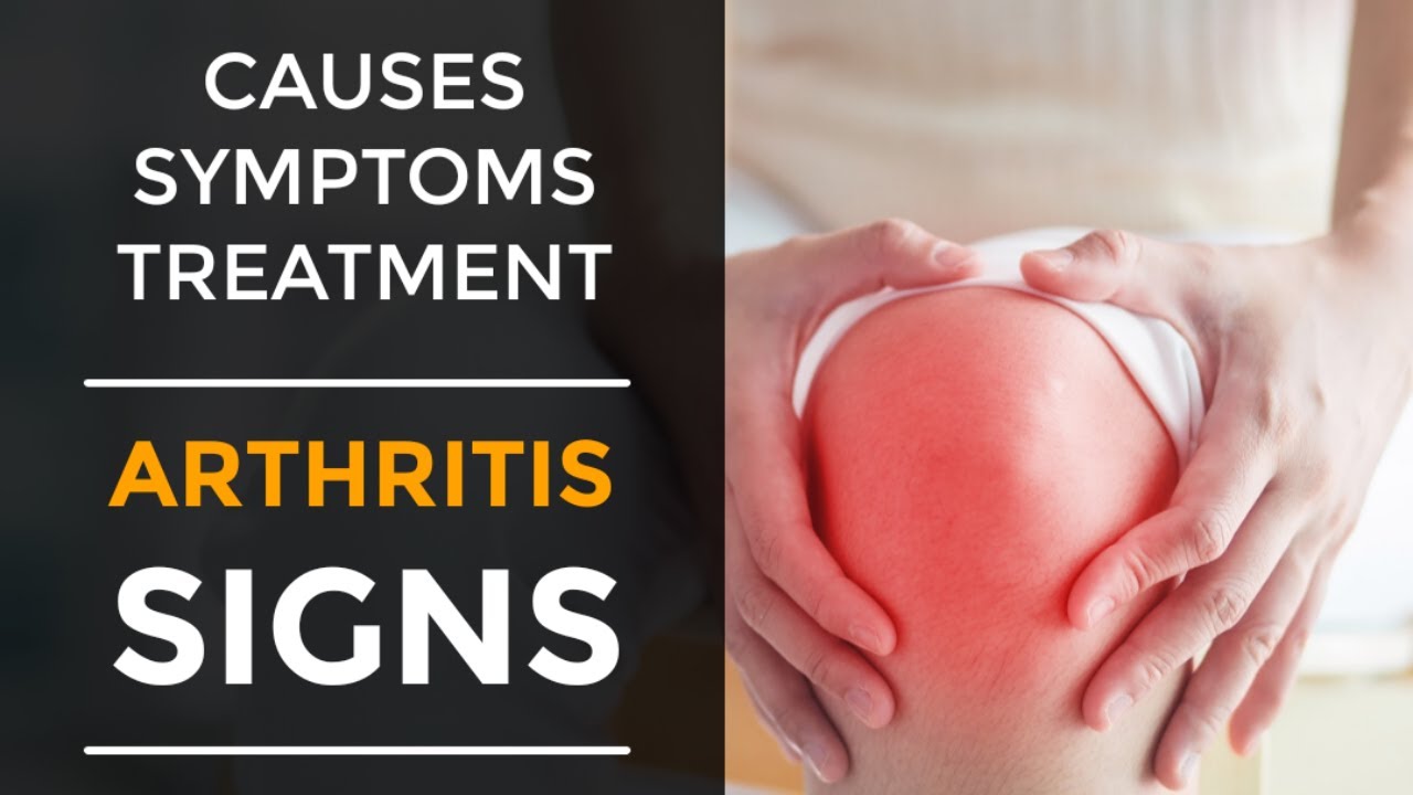 Arthritis Causes Signs Symptoms Treatment // Main Types Of Arthritis