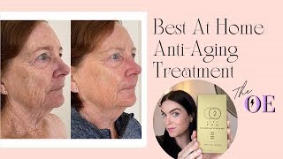 Best At Home Anti-Aging Treatment | CO2 Lift Pro Carboxy Therapy Mask